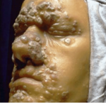 Bakas. Vaska mulāža Jules Baretta (1834-1923) 